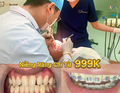 Hành Trình Niềng Răng Của Bạn Quí – Từ Tự Ti Đến Nụ Cười Tỏa Sáng