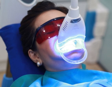 Tẩy trắng răng có hại cho men răng không? Nha khoa SV quận 3