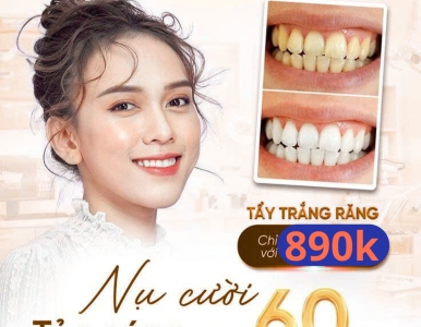 Tẩy Trắng Răng TPHCM – Nụ Cười Tỏa Sáng Chỉ Sau 60 Phút