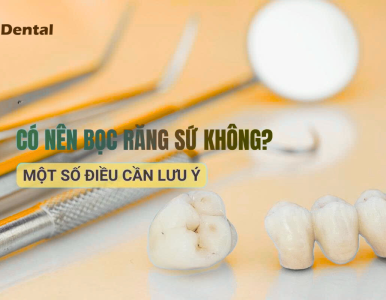 Có nên bọc răng sứ không? 6 điều cần lưu ý khi quyết định bọc răng sứ tại Nha Khoa SV