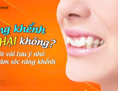 Răng khểnh có hại không? Những lưu ý quan trọng khi chăm sóc răng khểnh – Nha Khoa SV phân tích chi tiết