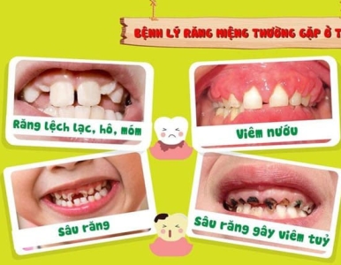 Bệnh lý răng miệng thường gặp ở trẻ em: Ba mẹ không nên chủ quan!