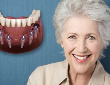 Người lớn tuổi có nên trồng răng implant không? Nha khoa SV quận 3 