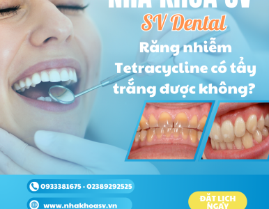 Răng nhiễm Tetracycline có tẩy trắng được không? Nha khoa SV quận 3 
