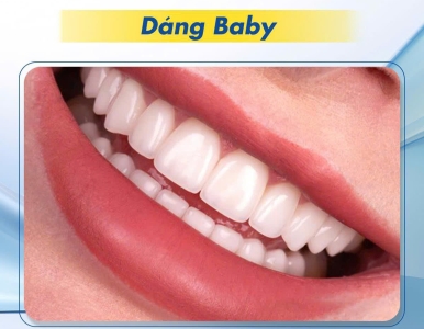 Nha khoa làm răng sứ đẹp tại quận 3- Nha khoa SV