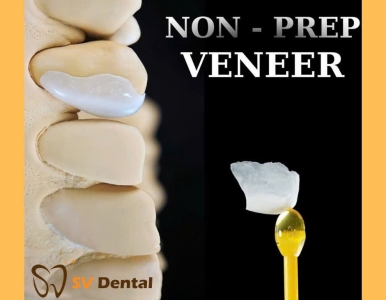 Địa chỉ làm mặt dán sứ Non- Prep Veneer chất lượng tại quận 3 