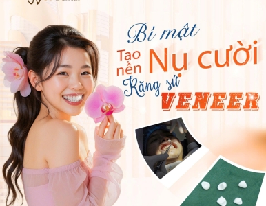  Ưu đãi 10% – 50% Răng Sứ Veneer tại Nha khoa SV Quận 3