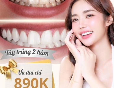 Tẩy trắng răng  890.000- Nụ cười rạng rỡ sau 60 phút