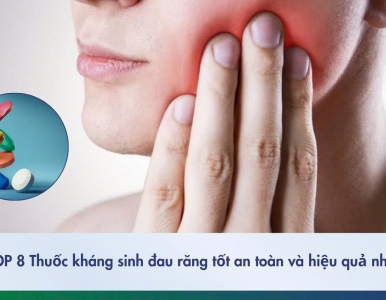 8 loại thuốc kháng sinh răng có tác dụng tiêu viêm và giảm đau hiệu quả