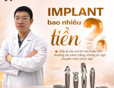 Implant Bao Nhiêu Tiền? Quy Trình Cấy Ghép Implant Tại Nha Khoa SV Chi Tiết Nhất