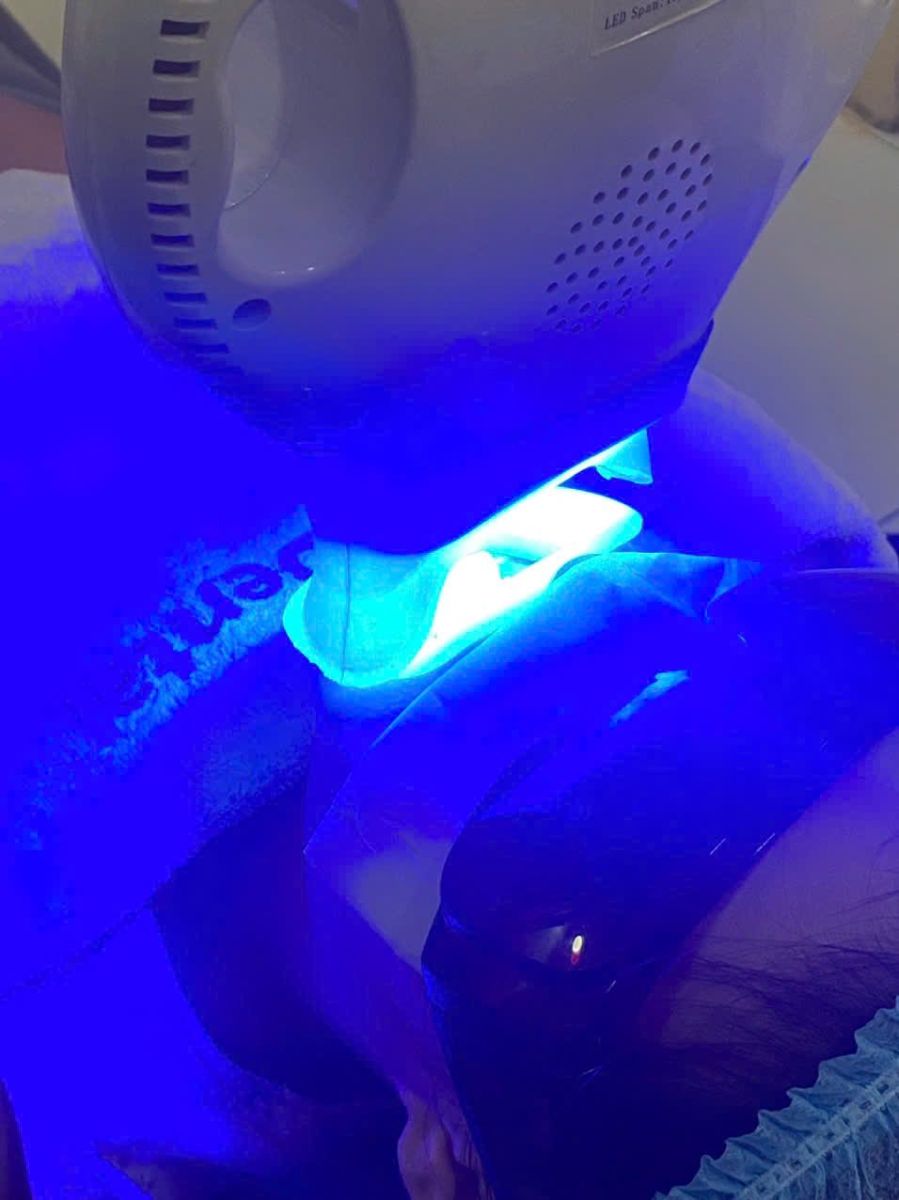 Hình ảnh giới thiệu về Tẩy trắng răng là gì?