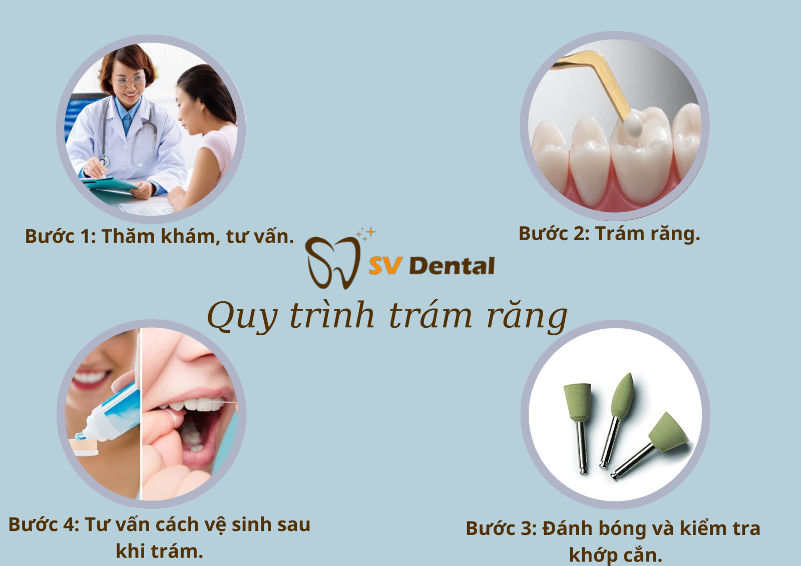 Quy Trình trám răng nha khoa SV