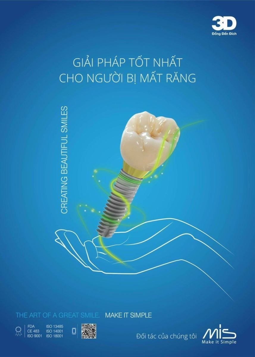 Trồng răng Implant Nha Khoa SV