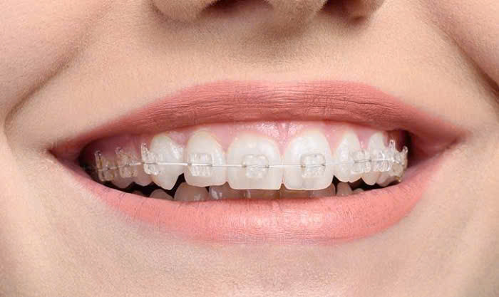 NHa khoa SV niền răng uy tín tại quận 3 