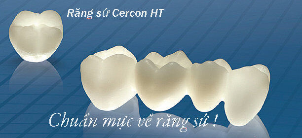 Răng sứ Cercon HT có nhiều ưu điểm vượt trội