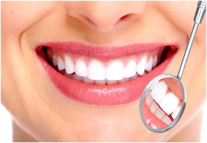 Hình ảnh trồng răng sứ tại nha khoa SV quận 3