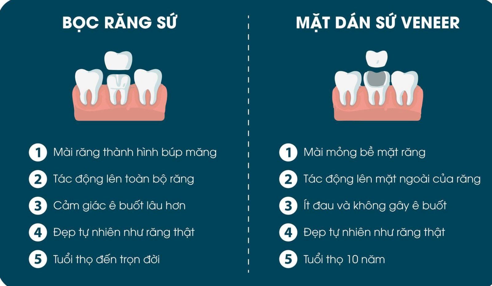 dán sứ vener Nha Khoa SV 