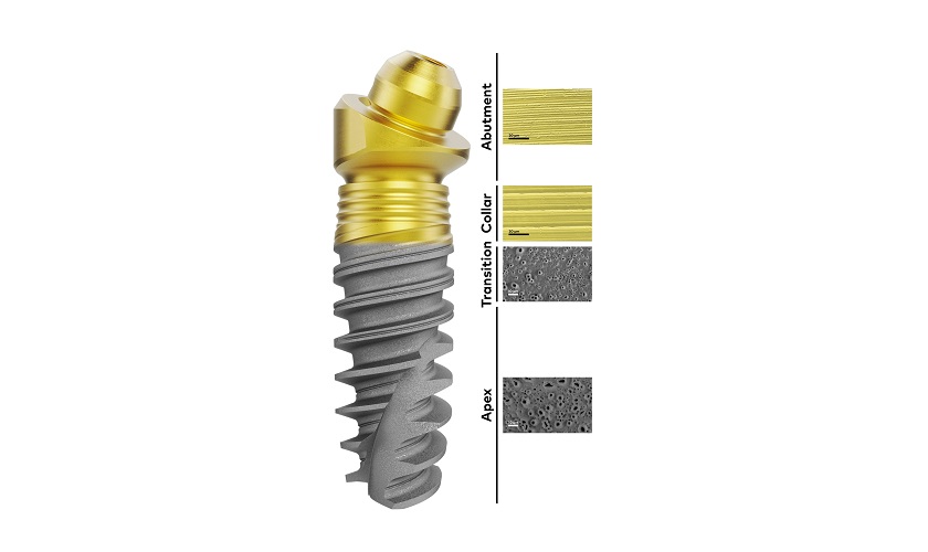 Trụ implant Nobel TiUltra có xuất xứ từ Thuỵ Điển