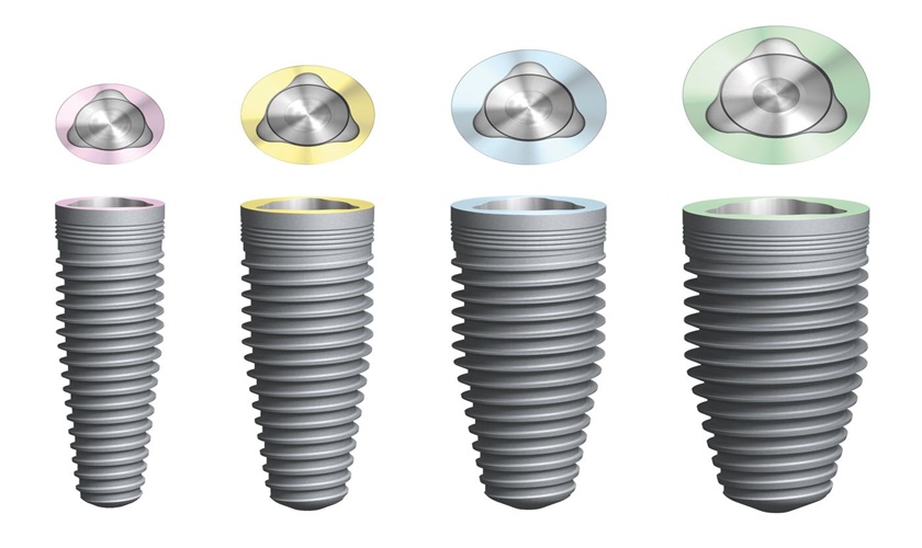 Giá cả trồng trụ implant Nobel TiUltra dao động từ 30- 33 triệu đồng