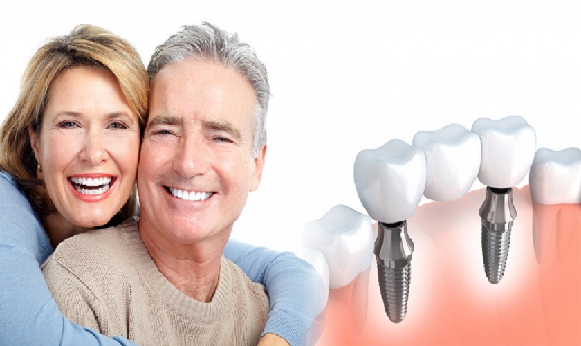 Trồng răng implant là giải pháp phục hình răng tốt cho người lớn tuổi hiện nay 