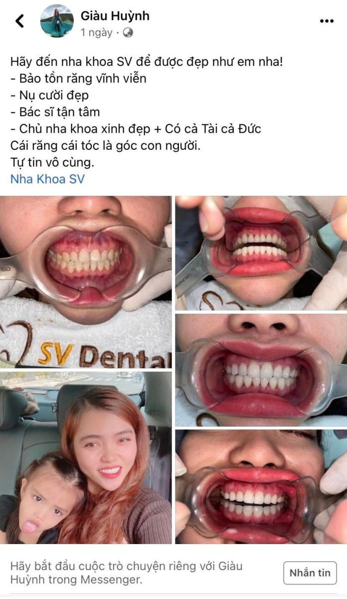 Hình ảnh Nha Khoa SV