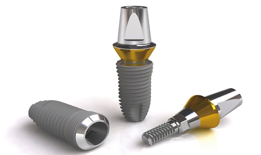 Hình ảnh về trụ Implant Nobel TiUltra