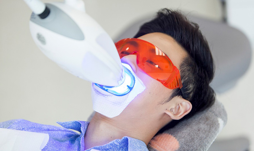 Tẩy trắng răng bằng phương pháp laser