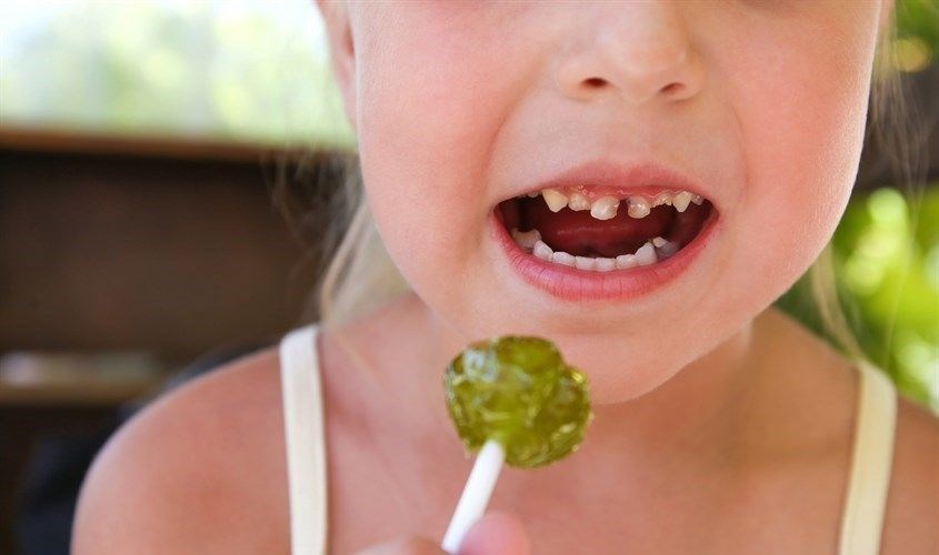 Trẻ em ăn nhiều bánh kẹo ngọt không vệ sinh đúng cách rất dễ bị sâu răng