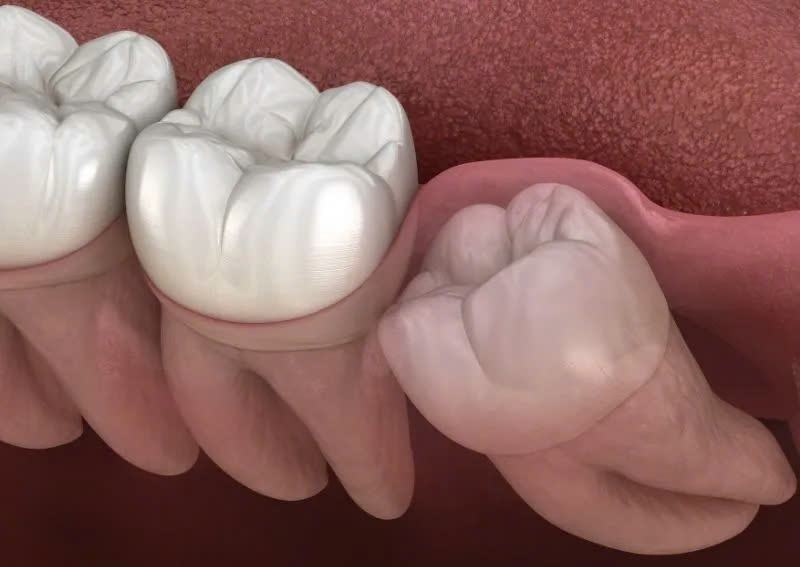 Hình ảnh dịch vụ tiểu phẩu nha khoa SV tại quận 3
