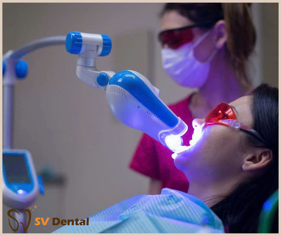 Hình ảnh tẩy trắng răng tại phòng khám Nha khoa SV quận 3