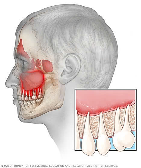 Hình ảnh chia sẽ kiến thức về sâu răng