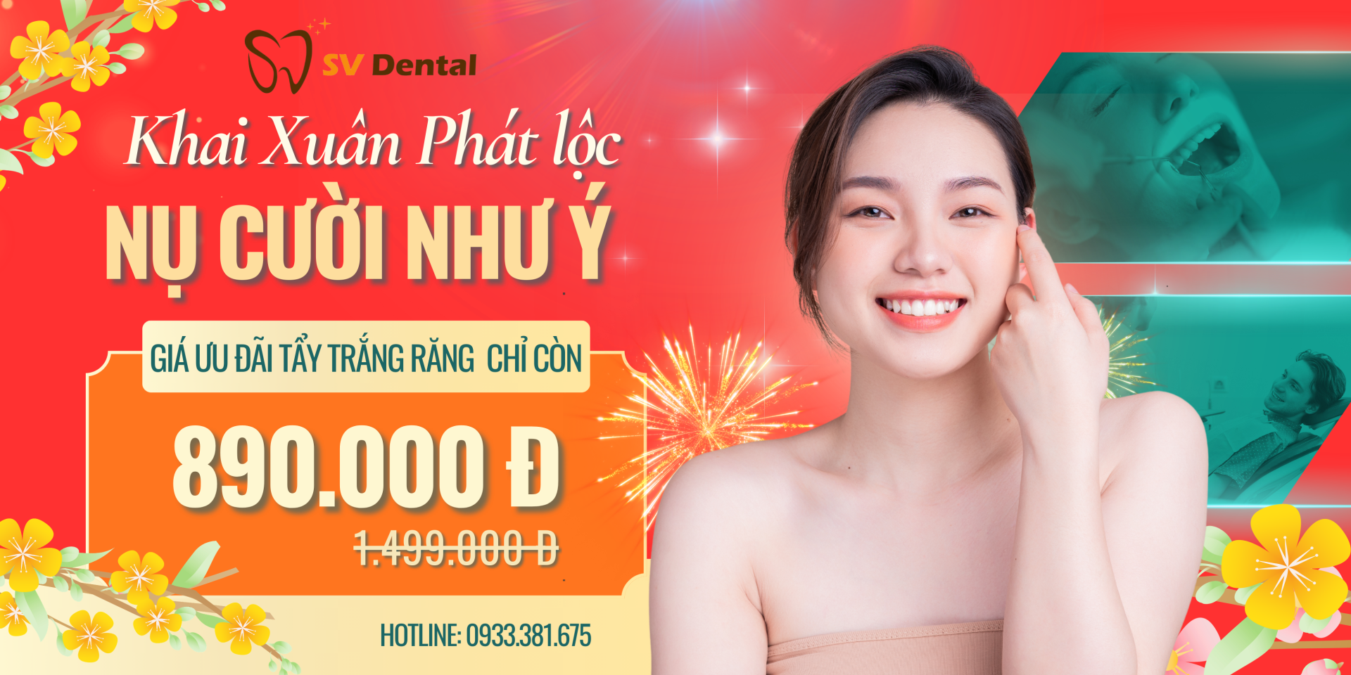 ưu đãi tẩy trắng răng chỉ 890.000