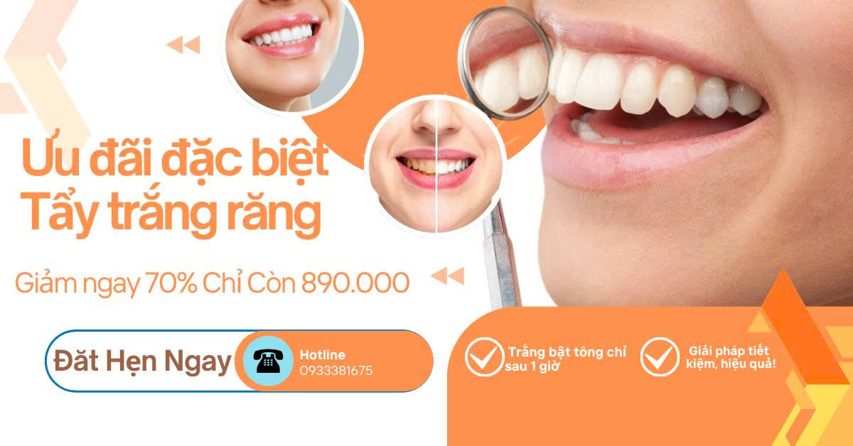 Ưu Đãi Tẩy Trắng Răng Giảm 70% Chỉ Còn 890.000